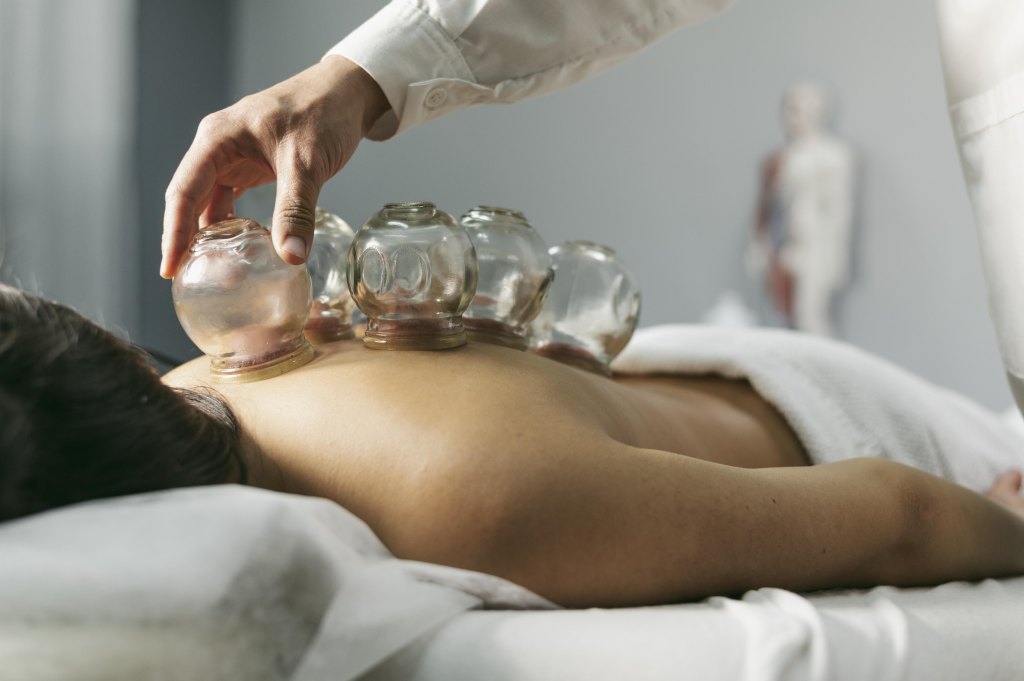 Terapeuti používajú suché bankovanie a bankovú masáž